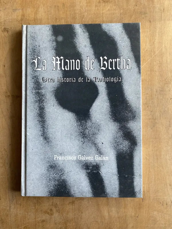 La Mano de Bertha historia de radiologia - Galvez Galan (n7